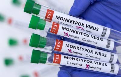 Ευλογιά των πιθήκων: 20 τα επιβεβαιωμένα κρούσματα στην Ελλάδα