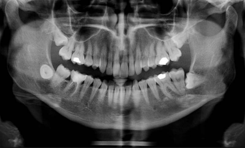 Ημερίδα Οδοντιατρικού Συλλόγου Μεσσηνίας για «Ακτινολογία και ακτινοδιάγνωση»