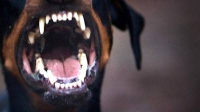 Πάτρα: Στο νοσοκομείο νοσηλεύεται 9χρονη, μετά την επίθεση που δέχθηκε από σκύλο