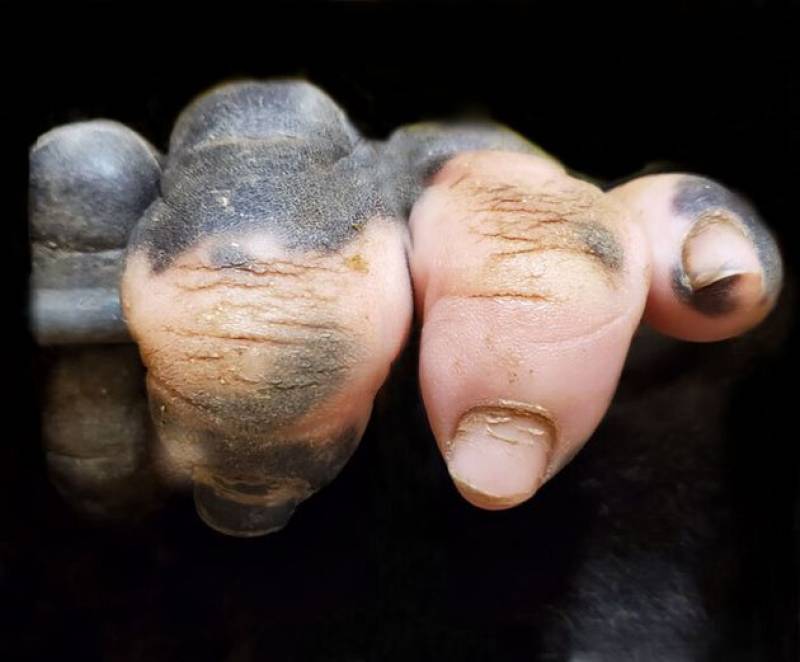 Ο γορίλας με τα ανθρώπινα δάχτυλα που έγινε viral (φωτο)