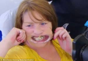 Εδώ και 10 χρόνια έφτιαχνε τα δόντια της με κόλλα στιγμής γιατί φοβόταν τον οδοντογιατρό