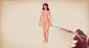 Αυτό το έξυπνο animation για τις υπερβολές στην πλαστική χειρουργική είναι τρομακτικό