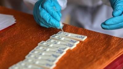 ΕΟΔΥ: 38 διασωληνωμένοι, 48 θάνατοι από Covid-19 την εβδομάδα από 2 έως 8 Οκτωβρίου