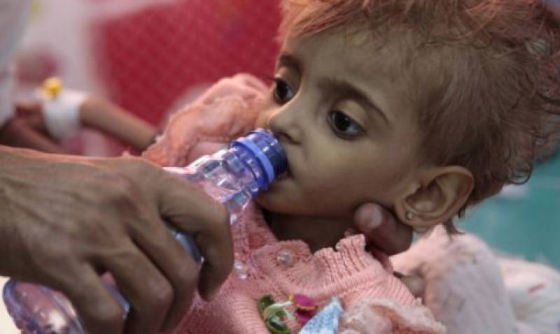 Unicef: 1,8 εκατ. παιδιά στην Υεμένη κάτω των 5 ετών σε κατάσταση οξέος υποσιτισμού
