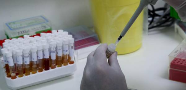 Αναστέλλεται η απεργία στα Μικροβιολογικά Εργαστήρια