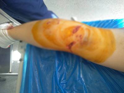 Η Λαϊκή Συσπείρωση για την επίθεση αδέσποτων σε εργαζόμενη γυναίκα στο Ασπρόχωμα