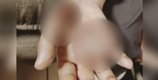 Νέα Σμύρνη: Βίαζε και βασάνιζε τη 10χρονη κόρη του - Την έκαιγε στο “μάτι” της κουζίνας (Βίντεο)