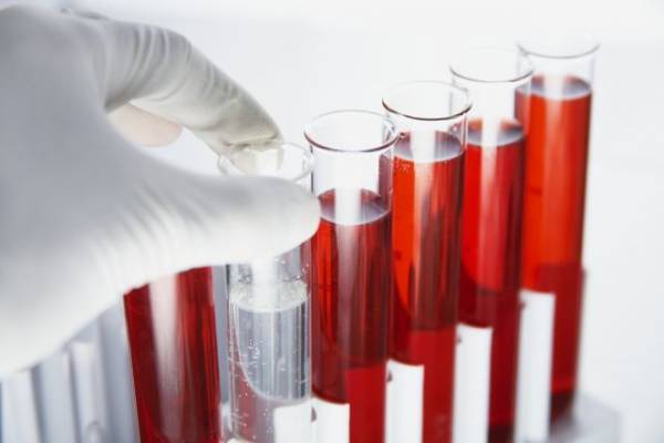 Νέο τεστ αίματος ανιχνεύει όχι μόνο τον καρκίνο, αλλά και πού αναπτύσσεται στο σώμα
