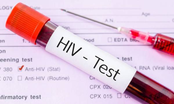 Ένα νέο σούπερ-αντίσωμα και ένα νέο φθηνό χάπι κατά του ιού HIV