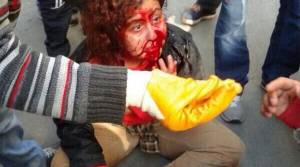 Κωνσταντινούπολη: Επεισόδια και τραυματίες στις πορείες για την Πρωτομαγιά