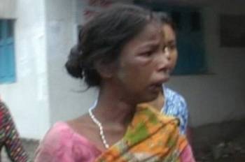 Φρίκη στην Ινδία: Αλκοολική μητέρα επιχείρησε να φάει ζωντανό το παιδί της