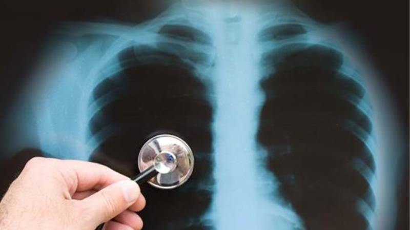 Αύξηση των θανάτων από φυματίωση παγκοσμίως-Δυσοίωνες οι προβλέψεις για τα επόμενα χρόνια