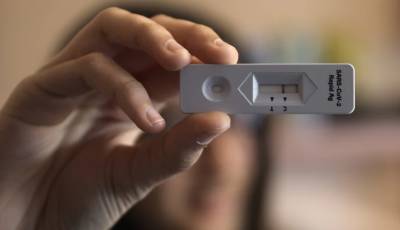 Ανεμβολίαστοι εργαζόμενοι: Παρατείνεται η υποβολή των υπεύθυνων δηλώσεων των εργοδοτών για τα τεστ κορονοϊού