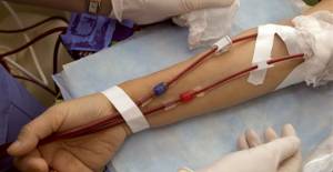 Θεσσαλονίκη: Έρευνα για πιθανό καρτέλ στα φίλτρα αιμοκάθαρσης