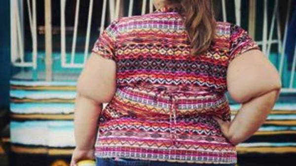 2,7 δισ ενήλικες θα είναι υπέρβαροι ή παχύσαρκοι το 2025