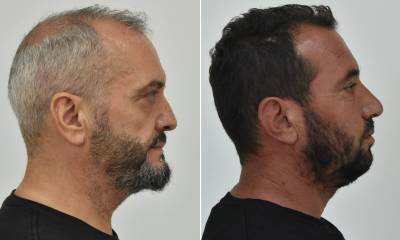 Απολογήθηκαν οι δύο κατηγορούμενοι στην υπόθεση του Κολωνού