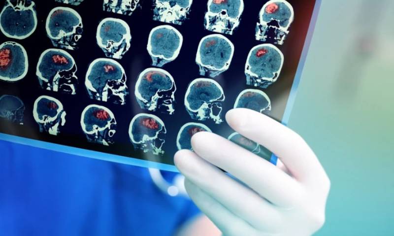 Κορονοϊός: Η βαριά λοίμωξη μπορεί να προκαλέσει νευρολογικά προβλήματα στον εγκέφαλο