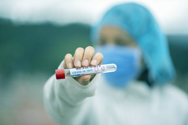 Γεωργιάδης: Κοντά στα 50 ευρώ η τιμή του μοριακού τεστ (PCR) - Θα εκδοθεί σήμερα η νέα ΚΥΑ