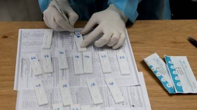 Κορονοϊός: 82 κρούσματα στη Μεσσηνία - Θάνατος 60χρονου στο Νοσοκομείο Καλαμάτας