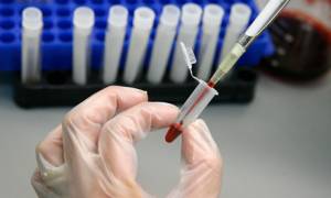 Δωρεάν εξέταση για HIV και ηπατίτιδες Β και C στους τσιγγάνους