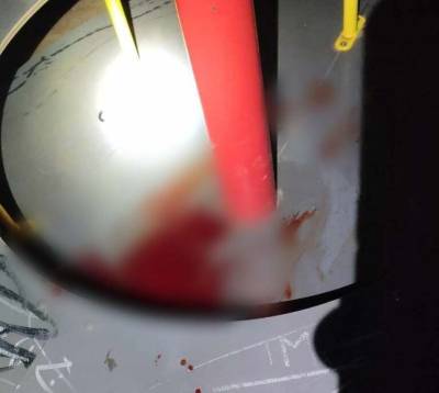 Αλεξανδρούπολη: 14χρονη τραυματίστηκε σε παιδική χαρά