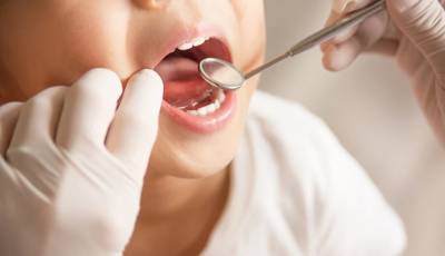 Dentist pass για παιδιά: Νέοι δικαιούχοι - Tι καλύπτει το πρόγραμμα (Βίντεο)