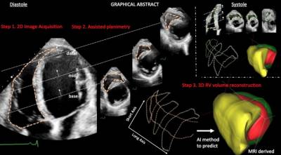 Πρωτοποριακή μέθοδος Ελλήνων επιστημόνων ανιχνεύει καρδιακά προβλήματα