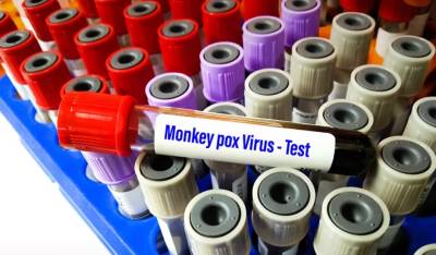 Ευλογιά των πιθήκων: Τέταρτο κρούσμα στην Ιταλία