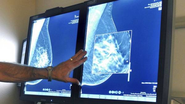 Η τεχνητή νοημοσύνη στη μάχη κατά του καρκίνου του μαστού