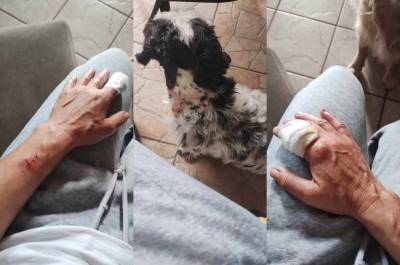 Ηγουμενίτσα: Γυναίκα δέχθηκε επίθεση από πίτμπουλ