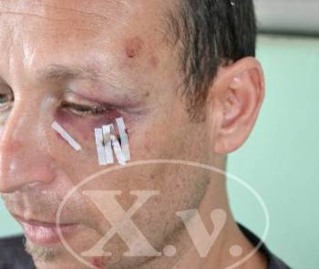 Ο Ιατρικός Σύλλογος Καλαμάτας καταγγέλλει την επίθεση στον Μακρέα
