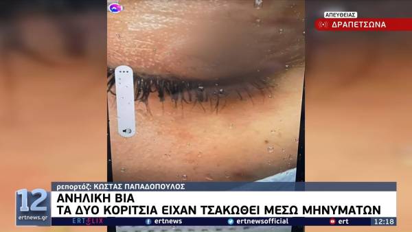 Δραπετσώνα: 16χρονη έσβησε τσιγάρο στο μάτι συμμαθήτριά της - Είχαν τσακωθεί μέσω μηνυμάτων (Βίντεο)