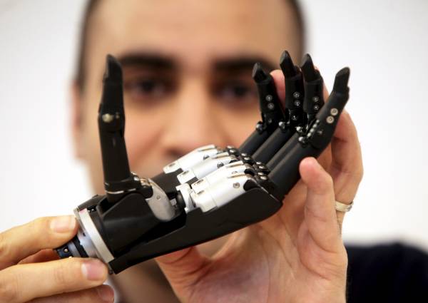 Το πρώτο βιονικό χέρι με τεχνητή νοημοσύνη (Βίντεο)