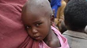 Σομαλία: Πάνω από ένα εκατομμύριο κάτοικοι υποφέρουν από υποσιτισμό