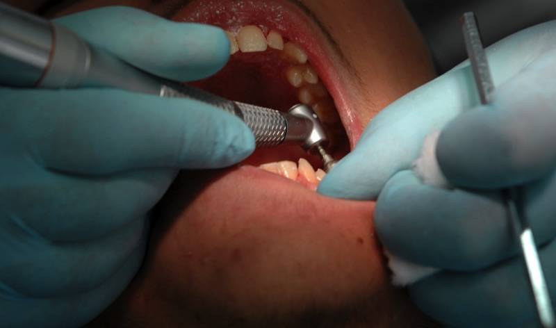 Παράταση προθεσμίας υποβολής αιτήσεων για το Dentist Pass έως 22 Δεκεμβρίου