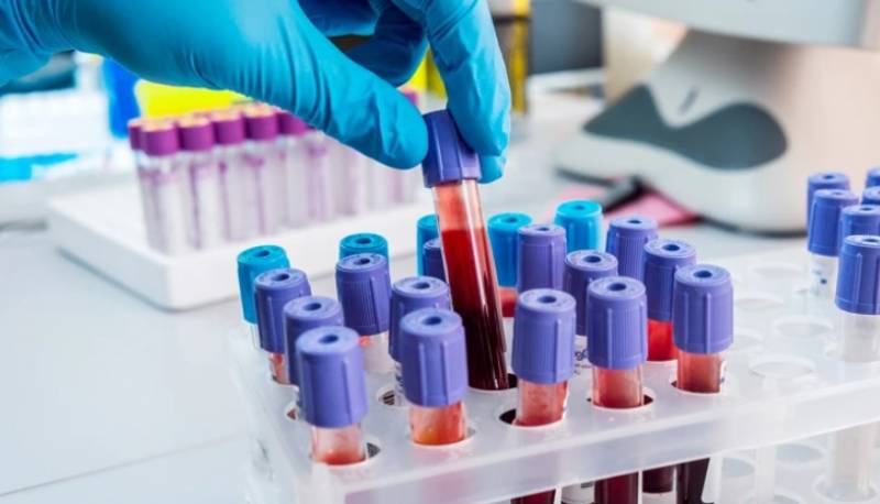 Κορονοϊός: Γρήγορο τεστ αίματος ανιχνεύει ποιοι κινδυνεύουν περισσότερο από σοβαρές επιπλοκές