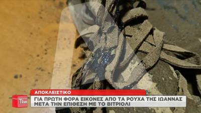 Επίθεση με βιτριόλι: Σοκάρουν οι φωτογραφίες από τα ρούχα της Ιωάννας τη μέρα της επίθεσης (Βίντεο)