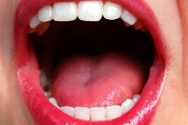 Ο καρκίνος του στόματος προτιμά όλο και νεότερους