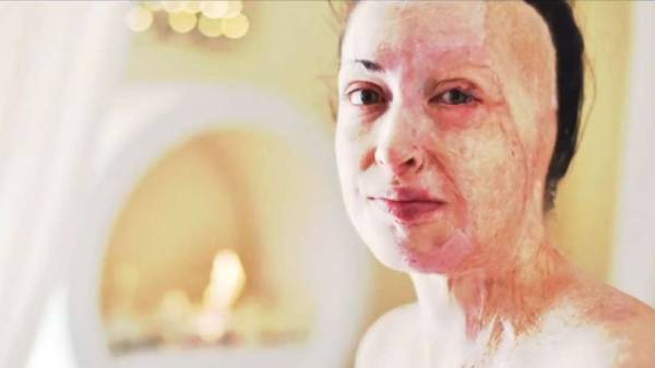 Ιωάννα Παλιοσπύρου: Έδειξε το πρόσωπό της και περιέγραψε τις δραματικές στιγμές της επίθεσης με το βιτριόλι (Βίντεο)
