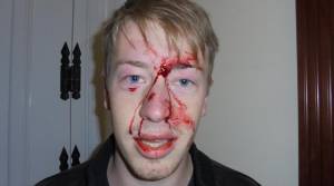 Γερμανός φοιτητής καταγγέλλει ξυλοδαρμό από τα ΜΑΤ