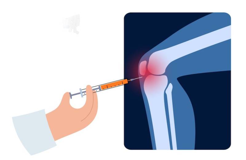 Οστεοαρθρίτιδα γόνατος: αποτελεσματική και ανώδυνη θεραπεία με PRP